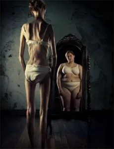 Anorexia in Santa Coloma de Gramenet
